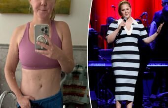 Amy Schumer exibe barriga tonificada após usar Mounjaro: “Sem filtro”