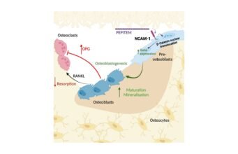 PEPITEM traz esperança para pessoas com osteoporose e artrite