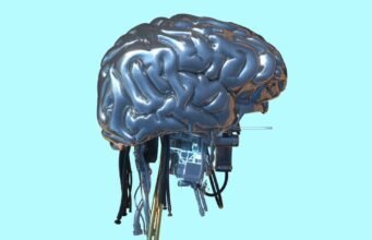 O que os insiders pensam anonimamente sobre a corrida da IA