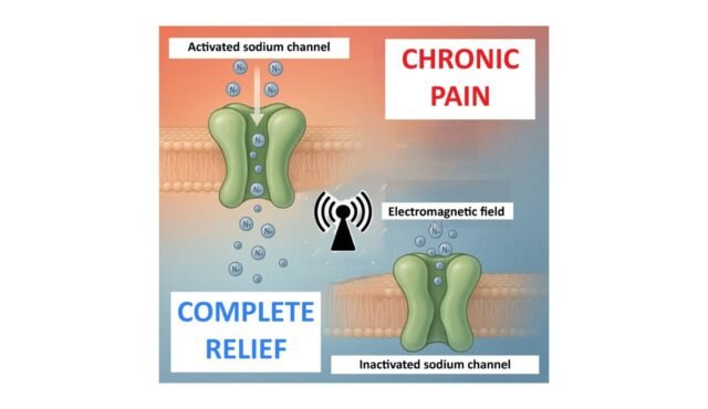 The-complete-relief-of-chronic-pain-utilizing-electromagnetic-theory-A-retrospective-observational-c.jpeg