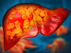 Adoçantes sem açúcar ainda podem danificar o fígado