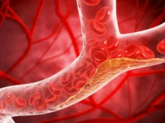 Novo medicamento reduz o colesterol “ruim” em 60% em grande ensaio