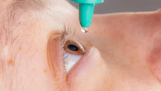eye-drop-glaucoma-treatment.webp.webp