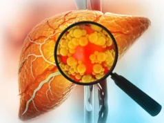 Tratamento promissor de fígado gorduroso pode aumentar risco de câncer