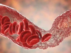 Cientistas finalmente resolvem o mistério dos raros coágulos sanguíneos da vacina COVID-19