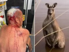 Australiano espancado em violento ataque de canguru ‘tem sorte de sobreviver’