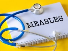 Mapa mostra surtos de sarampo nos Estados Unidos