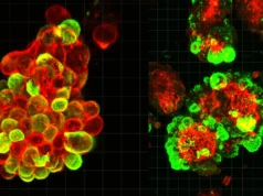 Aliança celular secreta pode explicar por que o câncer de ovário é tão mortal