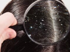 “Raspar minha cabeça vai curar minha caspa?”