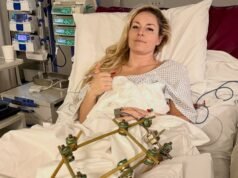 A velejadora da equipe dos EUA, Lindsey Vonn, ‘recebeu alta do hospital’ uma semana após o terrível acidente olímpico | Notícias do mundo