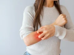 Cientistas descobrem camada de açúcar escondida por trás da psoríase