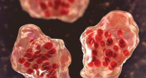 Dois locais de exposição ao sarampo foram identificados nos centros de saúde de Salem, disseram autoridades do Oregon