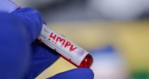 O HMPV, um vírus para o qual não existe vacina ou tratamento, está aumentando. Você deveria estar preocupado?