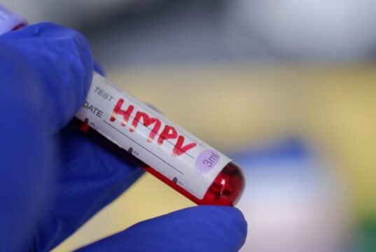 O HMPV, um vírus para o qual não existe vacina ou tratamento, está aumentando. Você deveria estar preocupado?