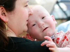 Crianças com complexidade médica: desafios e necessidade de mudança