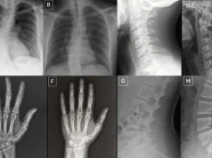 Raios-X deepfake tão reais que nem os médicos conseguem perceber a diferença