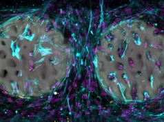 Implante de hidrogel impresso a laser pode transformar o reparo ósseo