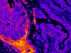 Descobrindo o metabolismo oculto dentro do núcleo celular