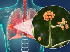 Esta simples proteína do sangue pode impedir o fungo negro mortal