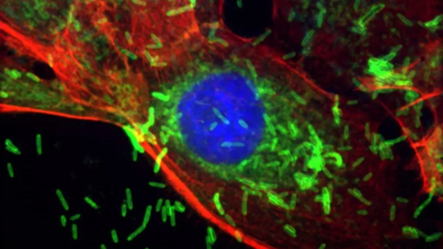 f-nucleatum-inside-breast-epithelial-cells.webp.webp