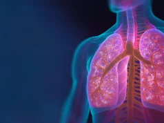 COVID-19 grave ou gripe podem aumentar o risco de câncer de pulmão anos depois