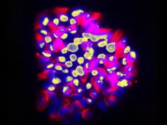 Nova ferramenta de inteligência artificial prevê propagação do câncer com precisão surpreendente