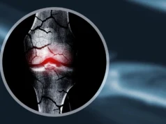 Cientistas criam estrutura de cartilagem para ajudar o corpo a regenerar ossos