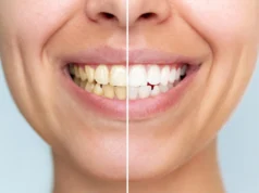 Este novo pó dental pode clarear os dentes sem prejudicá-los