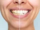 Este novo pó dental pode clarear os dentes sem prejudicá-los