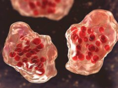 Uma escola secundária do sudeste de Portland foi exposta ao sarampo por vários dias