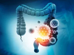 O que está escondido no câncer de cólon pode mudar o tratamento