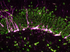 Este gás cerebral ‘ovo podre’ pode ser a chave para combater a doença de Alzheimer