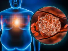 Homens e mulheres obesos enfrentam riscos de saúde ocultos distintos