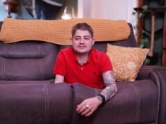 Adolescente cresce de 6’2 “para 2’8” após amputação abaixo da cintura