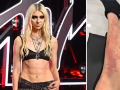 Taylor Momsen foi hospitalizado após uma picada de aranha venenosa durante uma viagem ao México