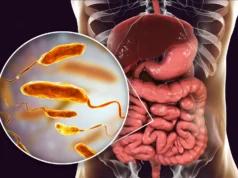 Esta dieta pode reduzir a infecção por cólera em 100 vezes