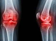 Cientistas descobrem uma maneira simples de aliviar a dor da artrite sem medicamentos ou cirurgia