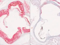 Cientistas descobrem interruptor hepático oculto que reduz o colesterol ruim