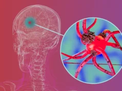 Pesquisadores bloqueiam proteína-chave que ajuda a propagação da doença de Parkinson no cérebro